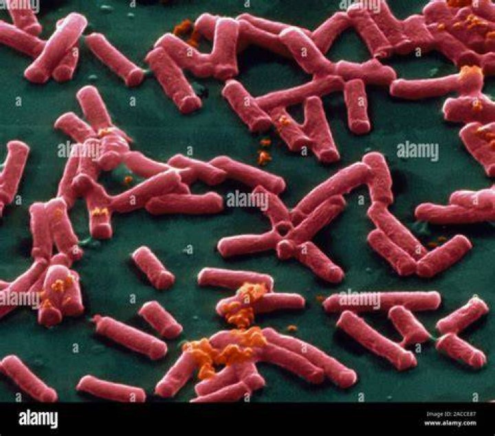 Clostridium Perfringens Bacteria