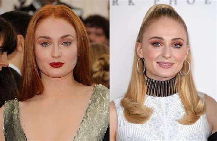 Did Sophie Turner Get Buccal Fat Removal Surgery? Fans On Twitter Are