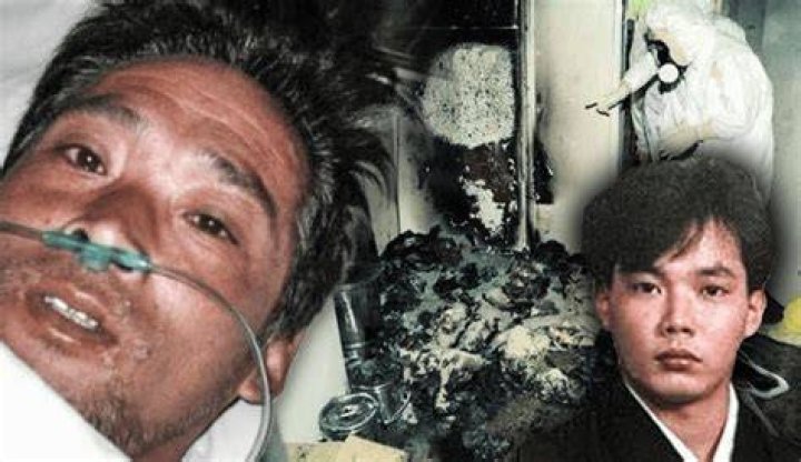 Hisashi Ouchi Real Photos Hospital Unveiling a Tragic Medical Case