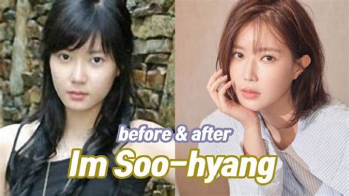 Im Soo Hyang Surgery Netizens Suspect Im Soohyang of Plastic Surgery