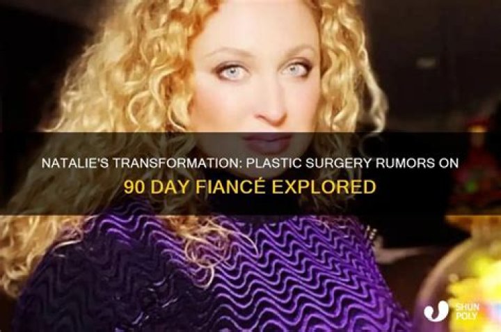 Natalie Mordovtseva Plastic Surgery Rumors In 90 Day Fiance 3