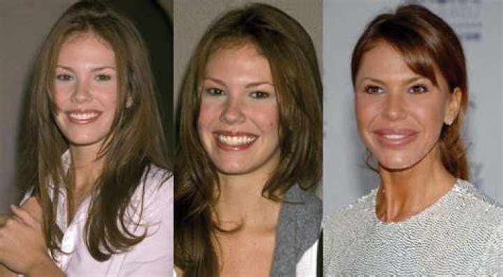 Nikki Cox Plastic Surgery The Ultimate Career Killer Celebrity Dr.