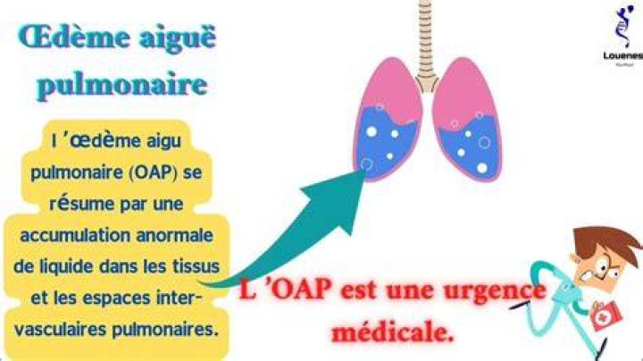OAP Oed&egrave;me pulmonaire cardiog&eacute;nique et par surcharge Rea ICU