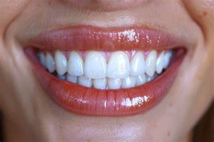 Woman with white teeth